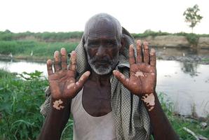पानी की कहानी - बिहार जल प्रदूषण के बीच हर घर शुद्ध जल के सरकारी दावों की योजना